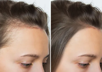 건강한 머리카락을 위한 한국산 안전하고 저렴한 탈모 억제제를 찾아보세요